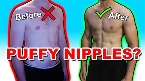 how to get rid of puffy nipples in women|Puffy Nipples and How To Get Rid of Them